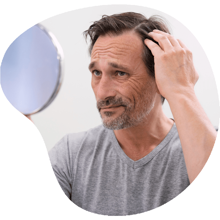Die 6 Vorteile der Haartransplantation