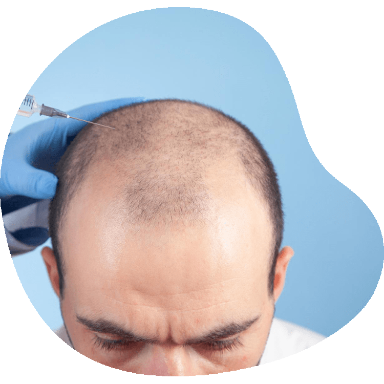 Erholungszeit für die Haartransplantation mit Stammzellen